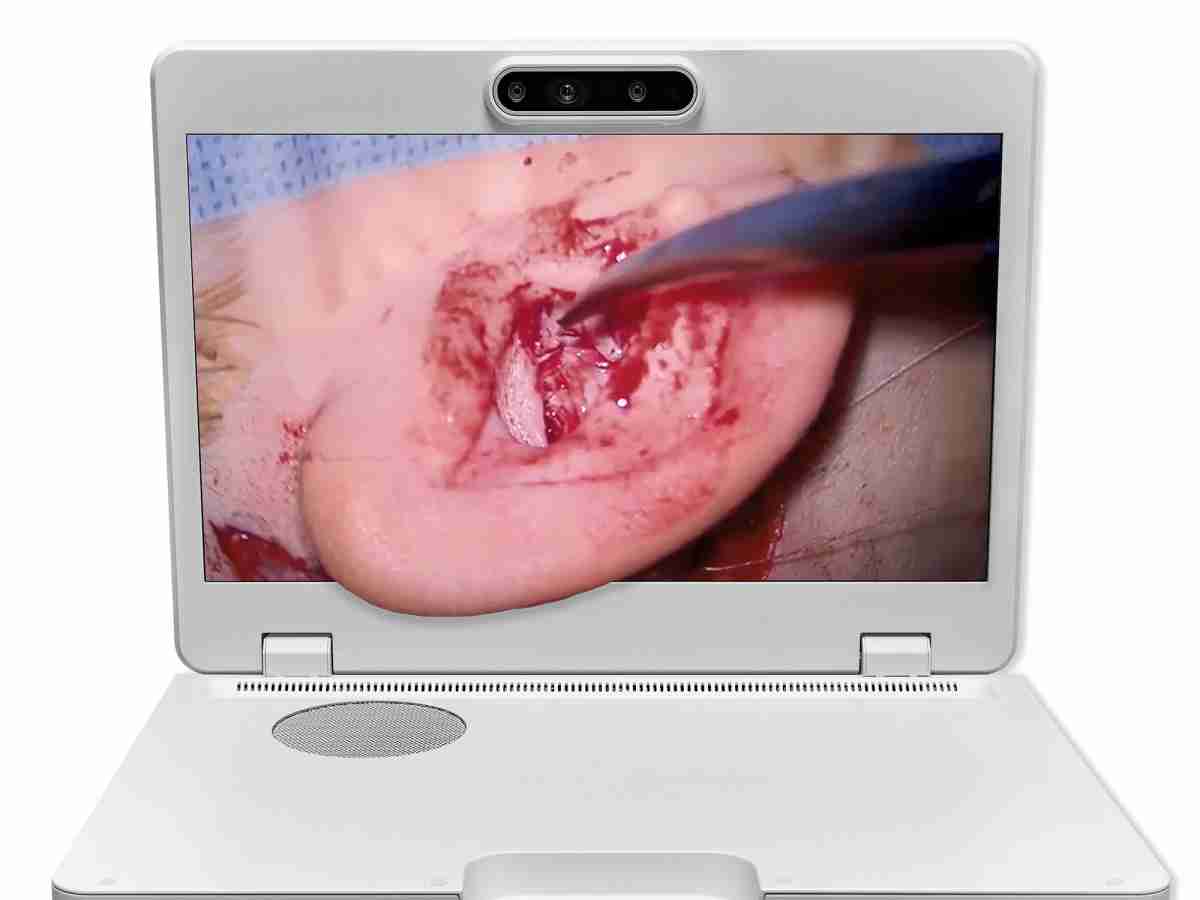 达擎之＂Heads-up 3D显微手术显示系统＂，，，整合4K裸眼3D显示及眼球追踪系统，，，，具备快速追踪人眼移动位置功能，，，，减轻医师长时间维持固定姿势的负担，，让医师能有更宽广清晰的3D立体视野及更舒适的姿势来执行手术。。